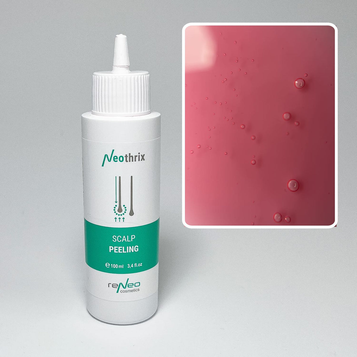 SCALP PEELING